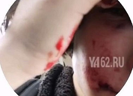 СК: хулиганы, избившие рязанских подростков в электричке, – граждане России