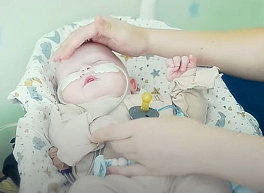Рязанскому малышу с синдромом короткой кишки нужно 1,7 млн рублей на питание